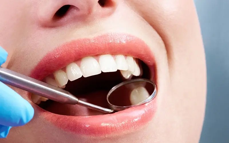 Featured image for “SMART Mercury Amalgam Removal: Safe Techniques for Healthier Smiles”