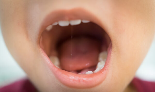 Inside of a boy mouth opening wide.