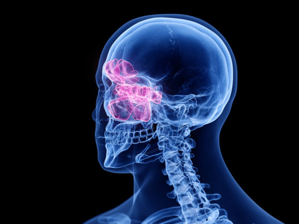 X-ray of a human head