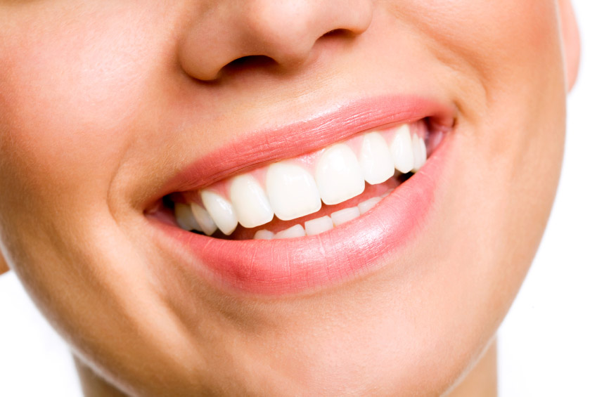 A woman smiling and showing her teeth