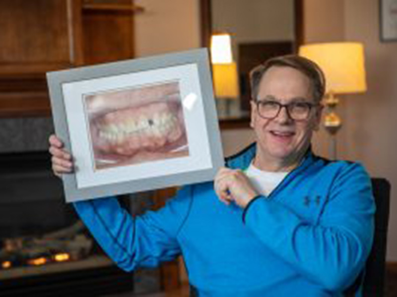 A man with a nice smile shows how strange his teeth used to be.