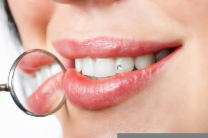 Woman showing her teeth to dentist