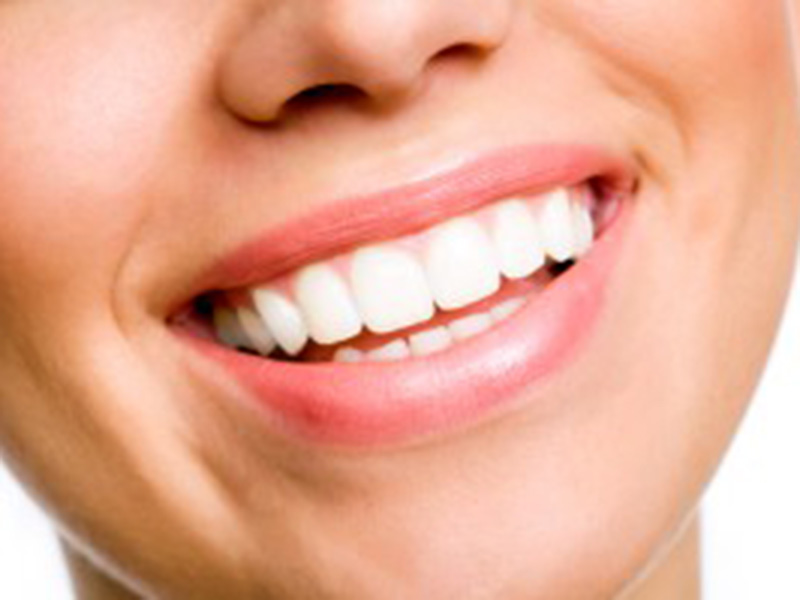 White smile. Learn about Dakota Dental's teeth whitening.