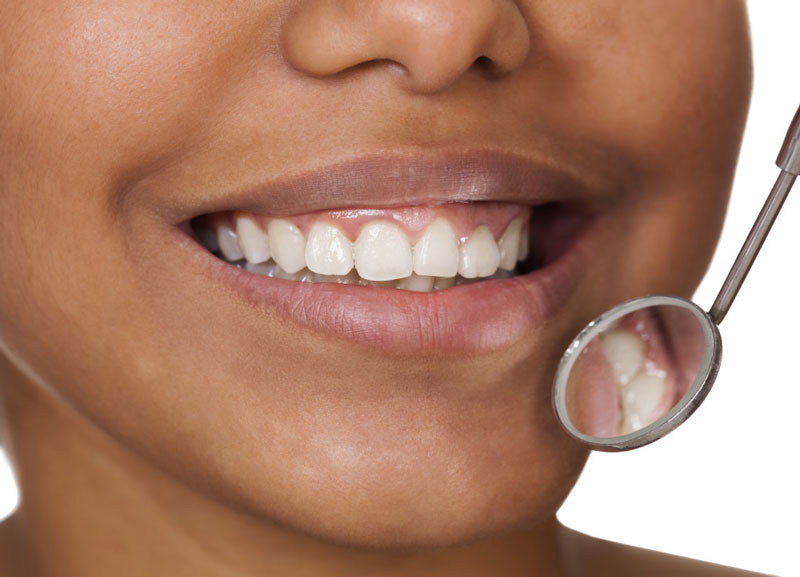 Woman showing her teeth to dentist
