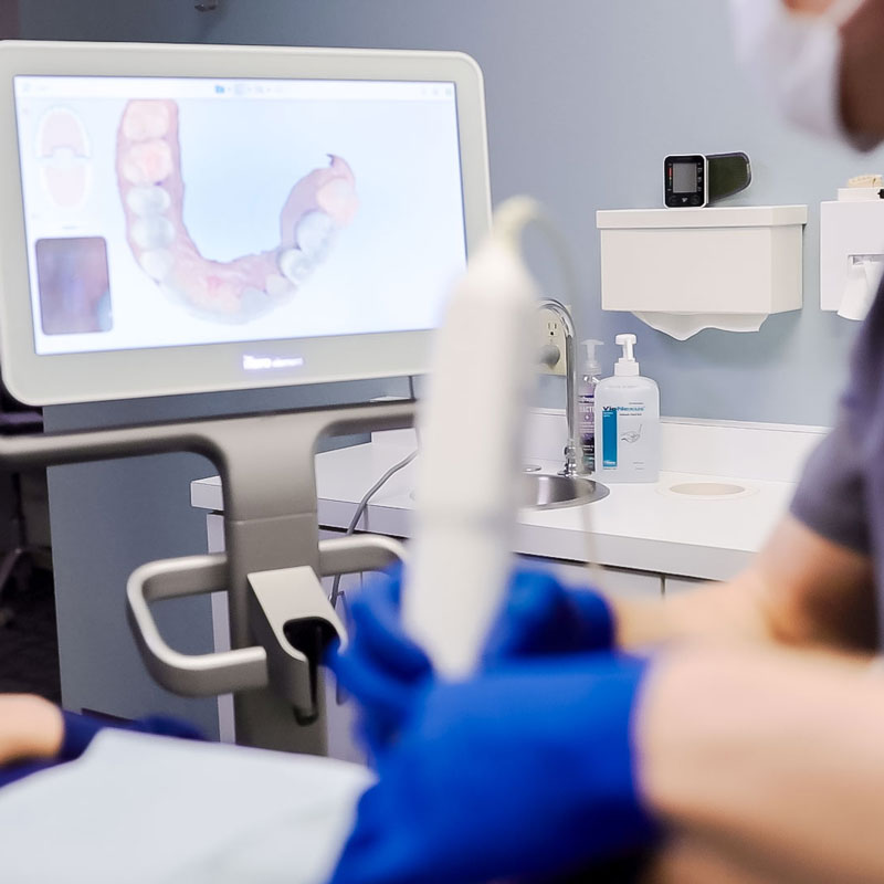 digital xrays of teeth