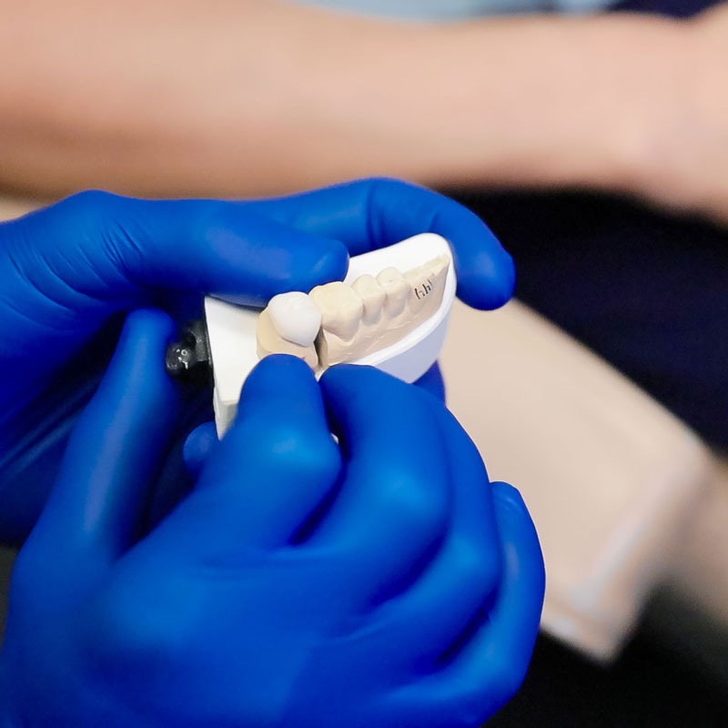 model of teeth