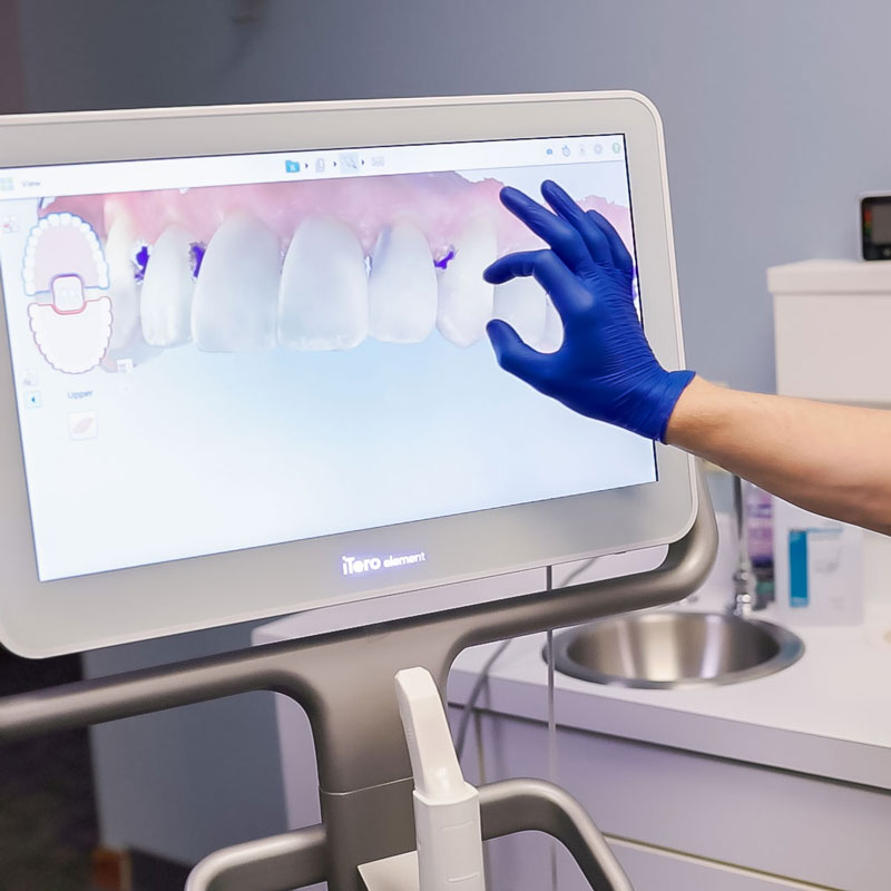 digital xrays of teeth